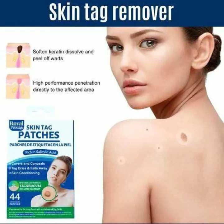 Royal Skin Tag Patch Blue Cotton 1 Pc