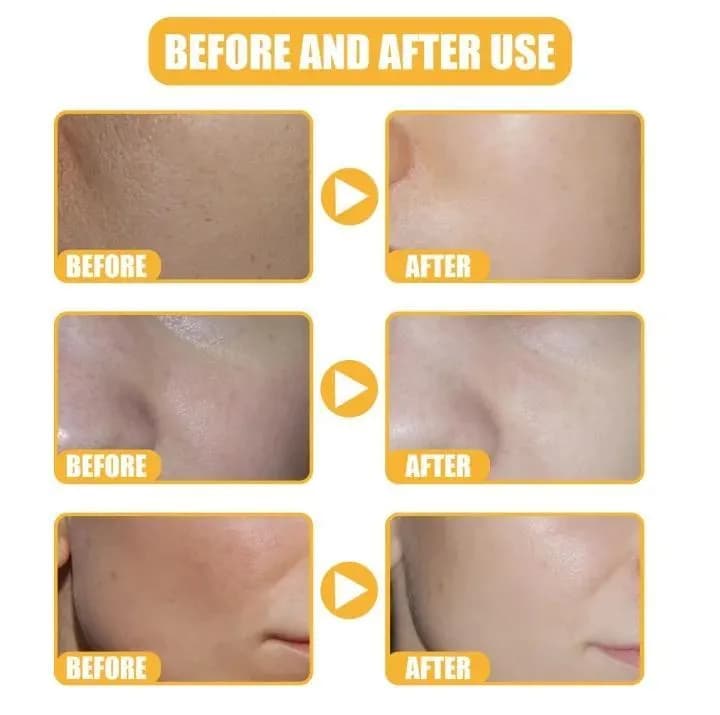 White Rice Serum for Skin Brightening & Acne Marks Removal