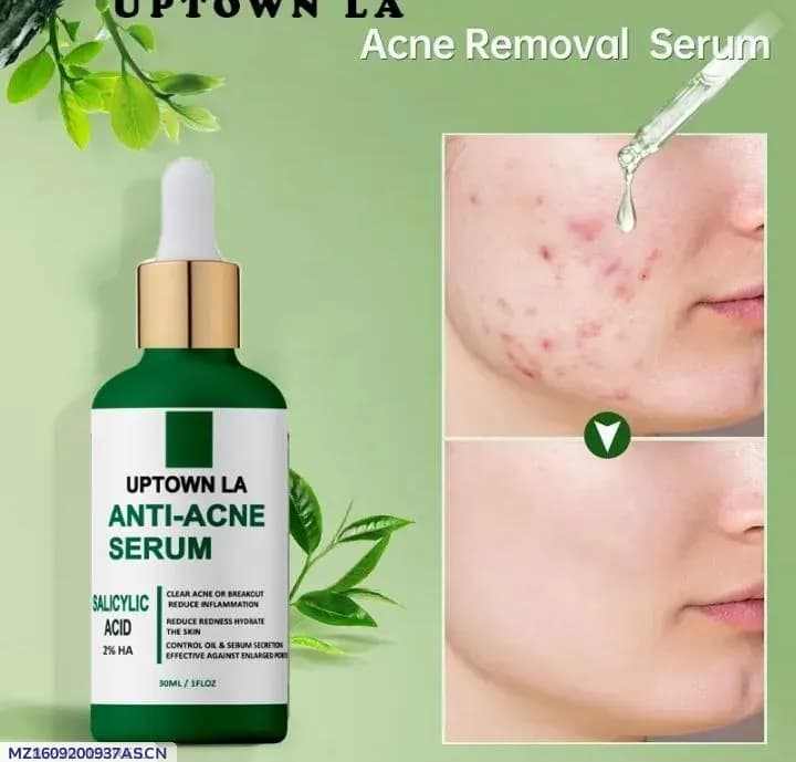Uptown Anti-Acne Serum 20% B3 Face Serum